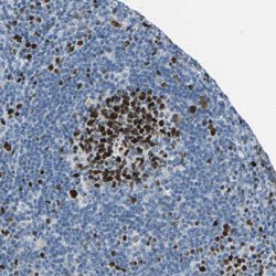 MCM4 Rabbit anti-Human, Polyclonal, Abnova 100uL:Antibodies, Polyclonal