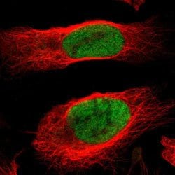 MCM4 Rabbit anti-Human, Polyclonal, Abnova 100uL:Antibodies, Polyclonal