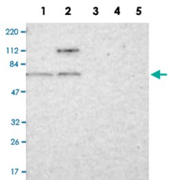 PRMT5 Rabbit anti-Human, Mouse, Rat, Polyclonal, Abnova 100uL:Antibodies,