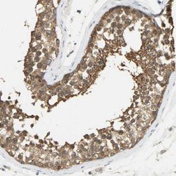 PRMT5 Rabbit anti-Human, Mouse, Rat, Polyclonal, Abnova 100uL:Antibodies,