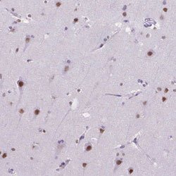 MEF2C Rabbit anti-Human, Polyclonal, Abnova 100 &mu;L | Buy Online | Abnova | Fisher Scientific