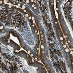 CDC25A Rabbit anti-Human, Polyclonal, Abnova 100uL:Anticuerpos