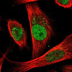 CDC25A Rabbit anti-Human, Polyclonal, Abnova 100uL:Anticuerpos