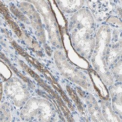 OCLN Rabbit anti-Human, Polyclonal, Abnova 100 &mu;L | Buy Online | Abnova Corporation | Fisher Scientific