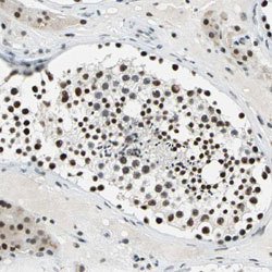 MYST4 Rabbit anti-Human, Polyclonal, Abnova 100uL:Antibodies, Polyclonal