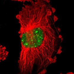 MYST4 Rabbit anti-Human, Polyclonal, Abnova 100uL:Antibodies, Polyclonal