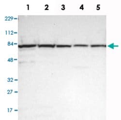 UBQLN2 Rabbit anti-Human, Polyclonal, Abnova 100uL:Antibodies, Polyclonal