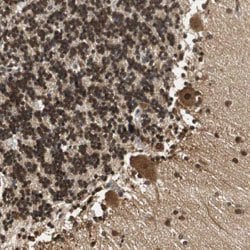 UBQLN2 Rabbit anti-Human, Polyclonal, Abnova 100uL:Antibodies, Polyclonal
