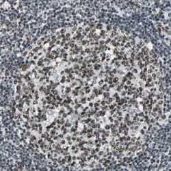 MEF2D Rabbit anti-Human, Mouse, Rat, Polyclonal, Abnova 100uL:Antibodies,