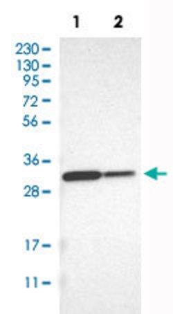 NQO1 Rabbit anti-Human, Polyclonal, Abnova 100 &mu;L | Buy Online | Abnova Corporation | Fisher Scientific