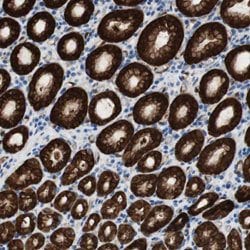 NQO1 Rabbit anti-Human, Polyclonal, Abnova 100 &mu;L | Buy Online | Abnova Corporation | Fisher Scientific