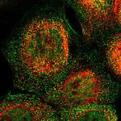Abnova Corporation RYR2 Rabbit anti-Human, Polyclonal, Abnova™