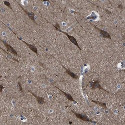 PAK7 Rabbit anti-Human, Polyclonal, Abnova 100uL:Antibodies, Polyclonal