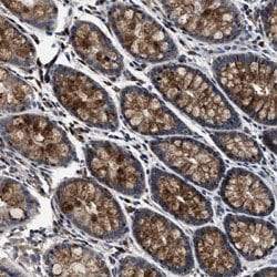 PHPT1 Rabbit anti-Human, Polyclonal, Abnova 100uL:Antibodies, Polyclonal