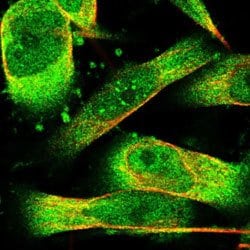 PHPT1 Rabbit anti-Human, Polyclonal, Abnova 100uL:Antibodies, Polyclonal