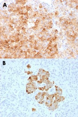 CHGA Rabbit anti-Human, Polyclonal, Abnova 100ug:Antibodies, Polyclonal