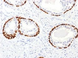 TP63 Rabbit anti-Human, Polyclonal, Abnova 100ug:Antibodies, Polyclonal