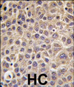 MTMR9 Rabbit anti-Human, Mouse, Polyclonal, Abnova&trade;