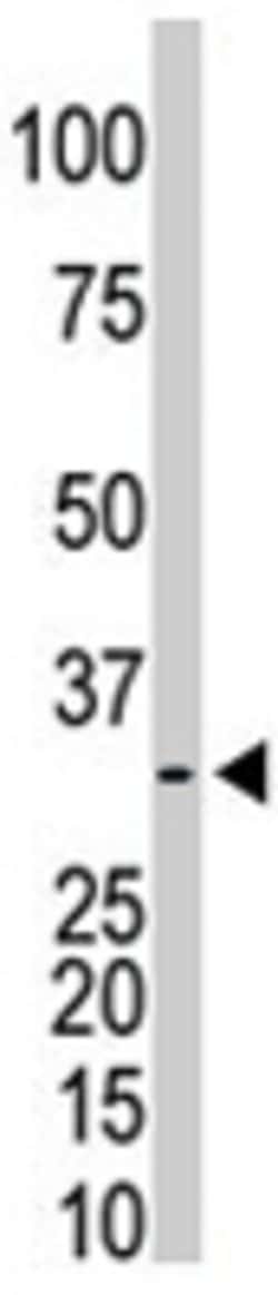 PRPS1/PRPS2/PRPS3 Rabbit anti-Human, Mouse, Polyclonal, Abnova 400uL:Antibodies,