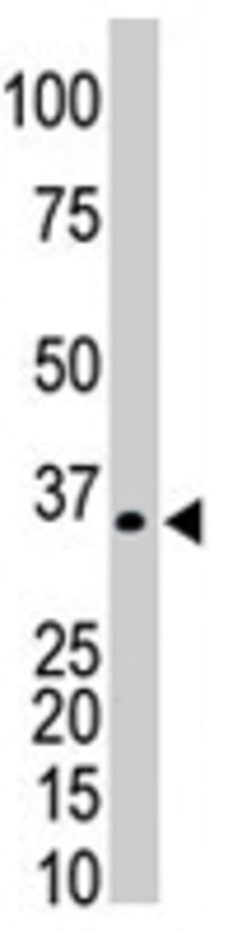 PRPS1/PRPS2/PRPS3 Rabbit anti-Human, Mouse, Polyclonal, Abnova 400uL:Antibodies,
