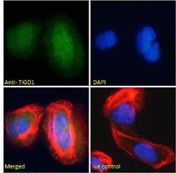 TIGD1, Goat, Polyclonal Antibody, Abnova 100&mu;g; Unlabeled:Antibodies,