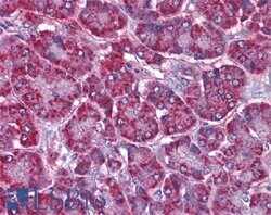 SORBS1 Goat, Polyclonal Antibody, Abnova 100 &mu;g | Buy Online | Abnova Corporation | Fisher Scientific