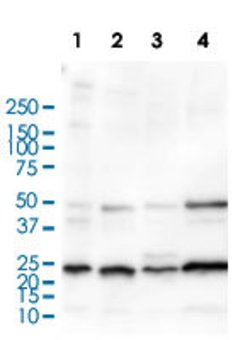 SCGB2A2 Rabbit anti-Human, Unconjugated, Clone: MGB1/2682R, Abnova 100