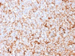 SCGB2A2 Rabbit anti-Human, Unconjugated, Clone: MGB1/2682R, Abnova 100