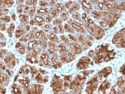 MUC1 Rabbit anti-Human, Mouse, Unconjugated, Clone: MUC1/2818R, Abnova