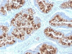 MUC1 Rabbit anti-Human, Mouse, Unconjugated, Clone: MUC1/2818R, Abnova