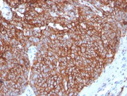 SLC2A1 Rabbit anti-Human, Unconjugated, Clone: GLUT1/3132R, Abnova 100