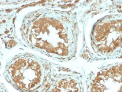VTCN1 Rabbit anti-Human, Unconjugated, Clone: B7H4/2652R, Abnova 100 &mu;g | Buy Online | Abnova Corporation | Fisher Scientific