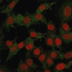 VTCN1 Rabbit anti-Human, Unconjugated, Clone: B7H4/2652R, Abnova 100 &mu;g | Buy Online | Abnova Corporation | Fisher Scientific
