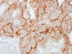 MUC16 Rabbit anti-Human, Unconjugated, Clone: OCA125/2349R, Abnova 100