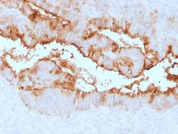 MUC16 Rabbit anti-Human, Unconjugated, Clone: OCA125/2349R, Abnova 100