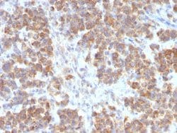 TNFSF15 Rabbit anti-Human, Unconjugated, Clone: VEGI/2052R, Abnova™
