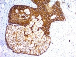 KRT77 Rabbit anti-Human, Unconjugated, Clone: KRTH/1576R + KRTL/15, Abnova