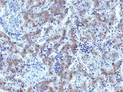 GPC3 Rabbit anti-Human, Rat, Unconjugated, Clone: GPC3/1534R, Abnova&trade;