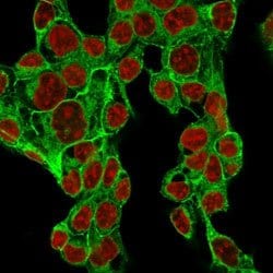 GPC3 Rabbit anti-Human, Rat, Unconjugated, Clone: GPC3/1534R, Abnova&trade;