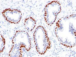TP63 Rabbit anti-Human, Mouse, Rat, Unconjugated, Clone: TP63/1423R, Abnova