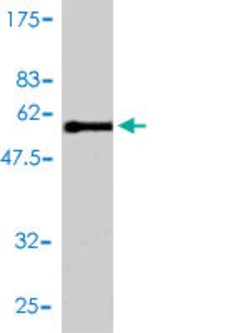 E2F6, Mouse, Clone: 2B6-G9, Abnova 100&mu;g; Unlabeled:Antibodies, Monoclonal