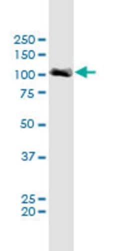 MCC Rat, Mouse anti-Human, Unconjugated, Polyclonal, (secondary), Abnova&trade;