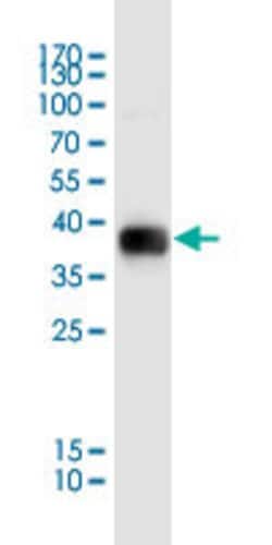 MSRA Mouse anti-Human, Clone: 3C11, Abnova 200uL:Antibodies, Cocktail