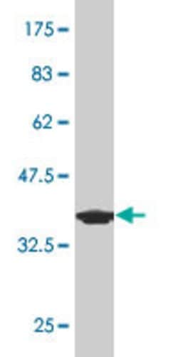 phosphodiesterase 1B, calmodulin-dependent, Mouse, Clone: 4F9, Abnova 100&mu;g;