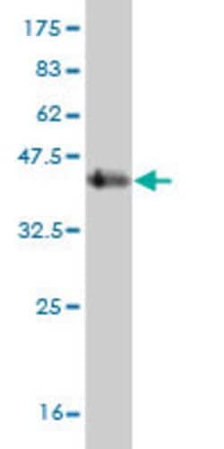 succinate dehydrogenase complex, subunit C, integral membrane protein, 15kDa, Mouse, Clone: 3G7, Abnova 100 &mu;g | Buy Online | Abnova Corporation | Fisher Scientific
