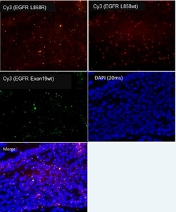 Abnova mutaFISH EGFR L858R L858wt Ex19wt RNA Probes