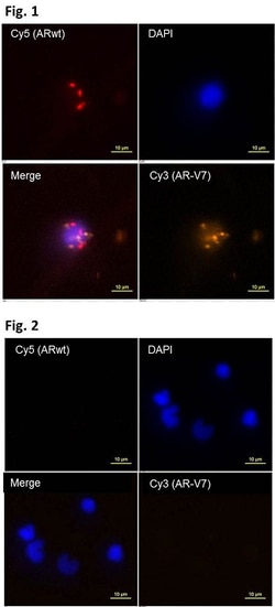 Abnova™ mutaFISH™ AR-V7 ARwt RNA Probes