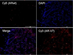 Abnova&trade;&nbsp;mutaFISH&trade; AR-V7 ARwt RNA Probes