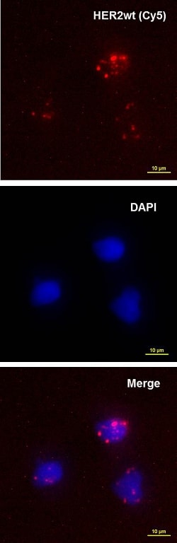 Abnova™ mutaFISH™ HER2wt DNA Probes