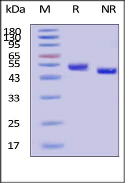 AcroBiosystems GMP Biotinylated Human CD5 Protein, His,AvitagTM 500 &mu;g | Buy Online | AcroBiosystems | Fisher Scientific